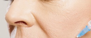 injection in face